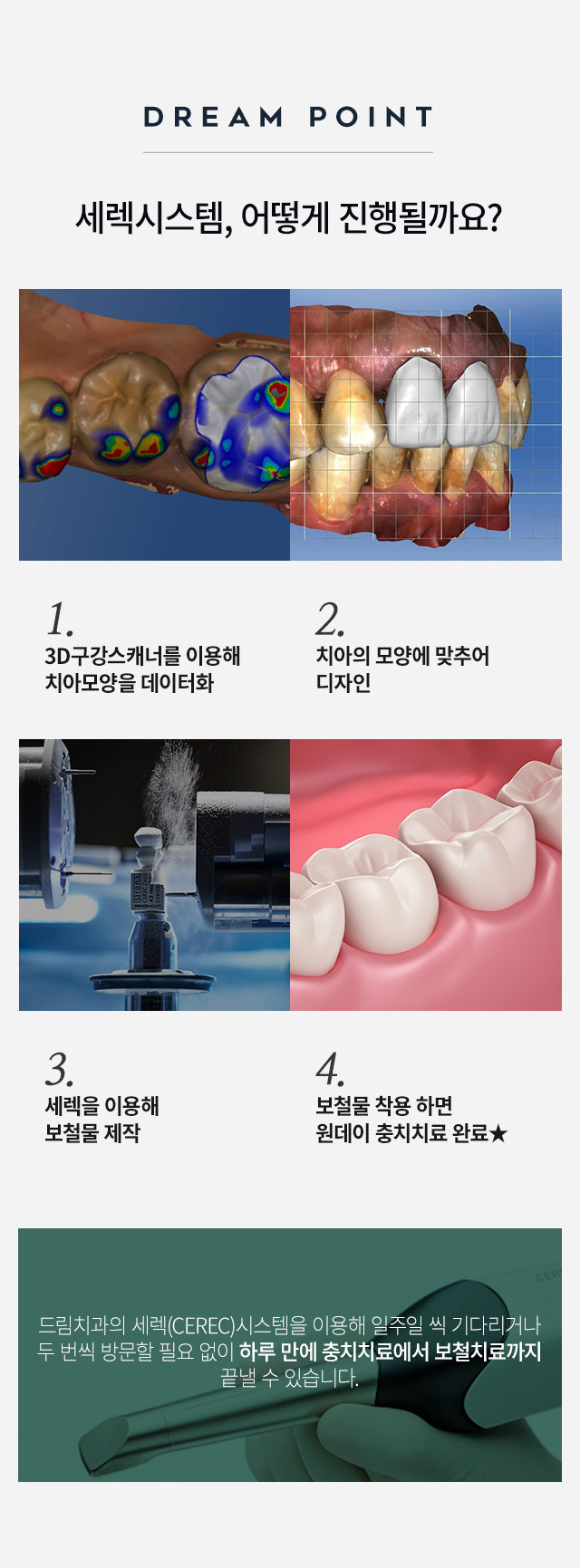 Crowding / Snaggle Tooth Correction