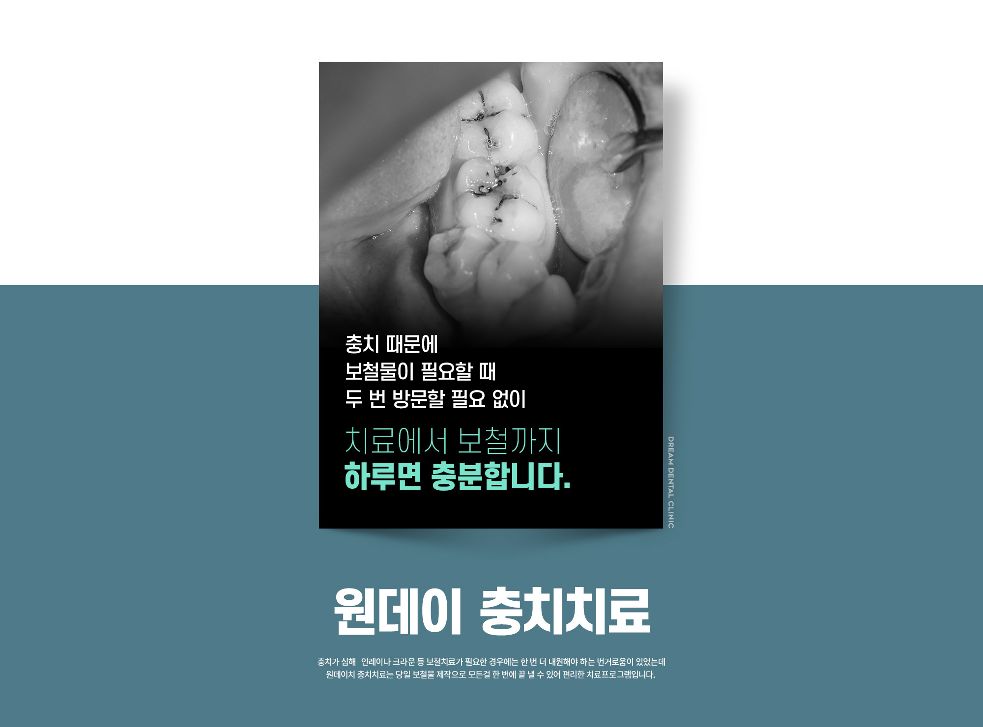 Ceramic Bracket Orthodontics