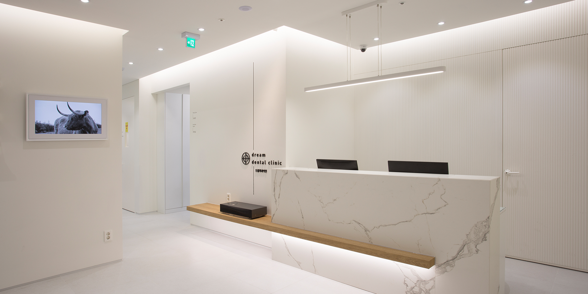 Resin Veneer (Tessera)