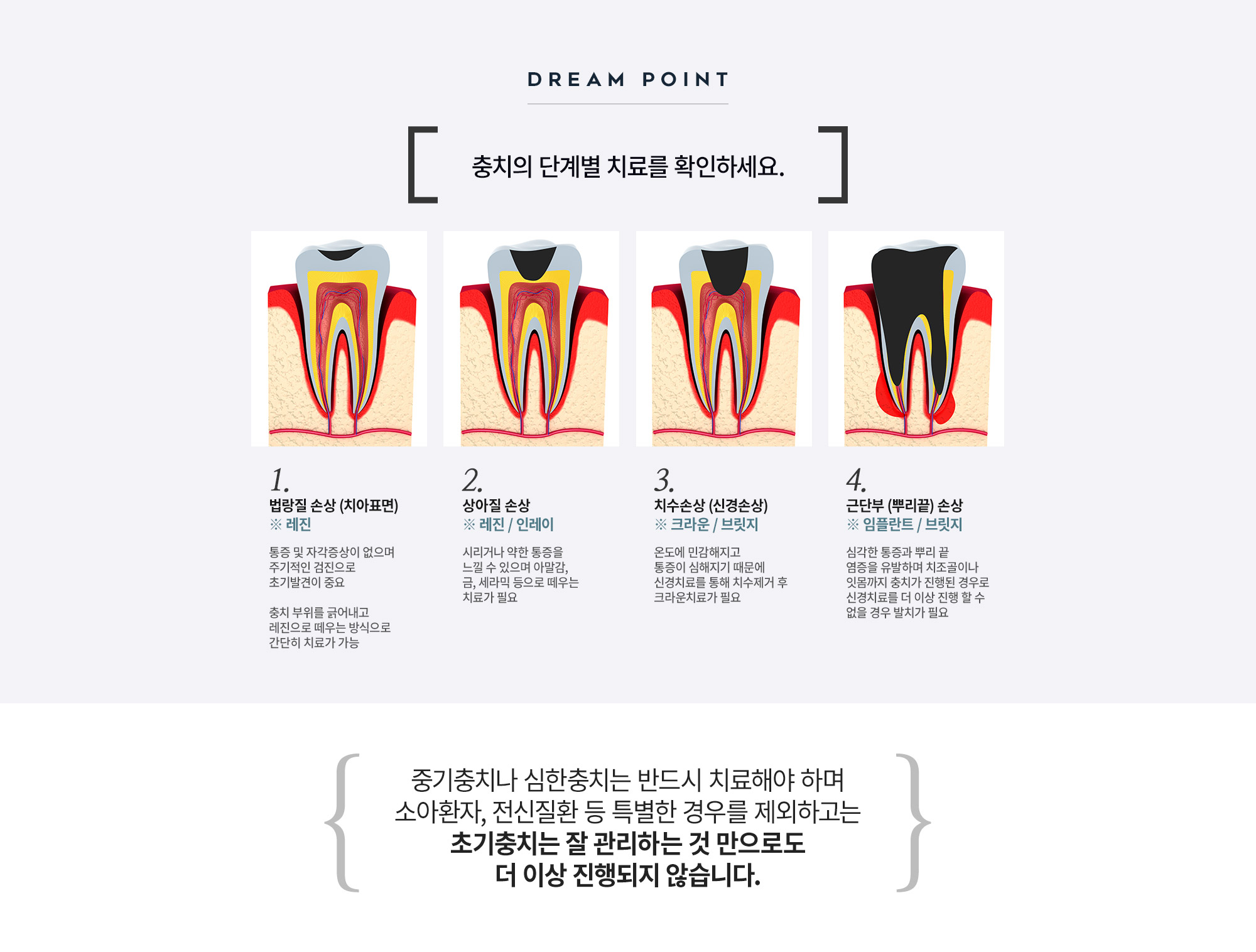 Self-Ligating Bracket Orthodontics