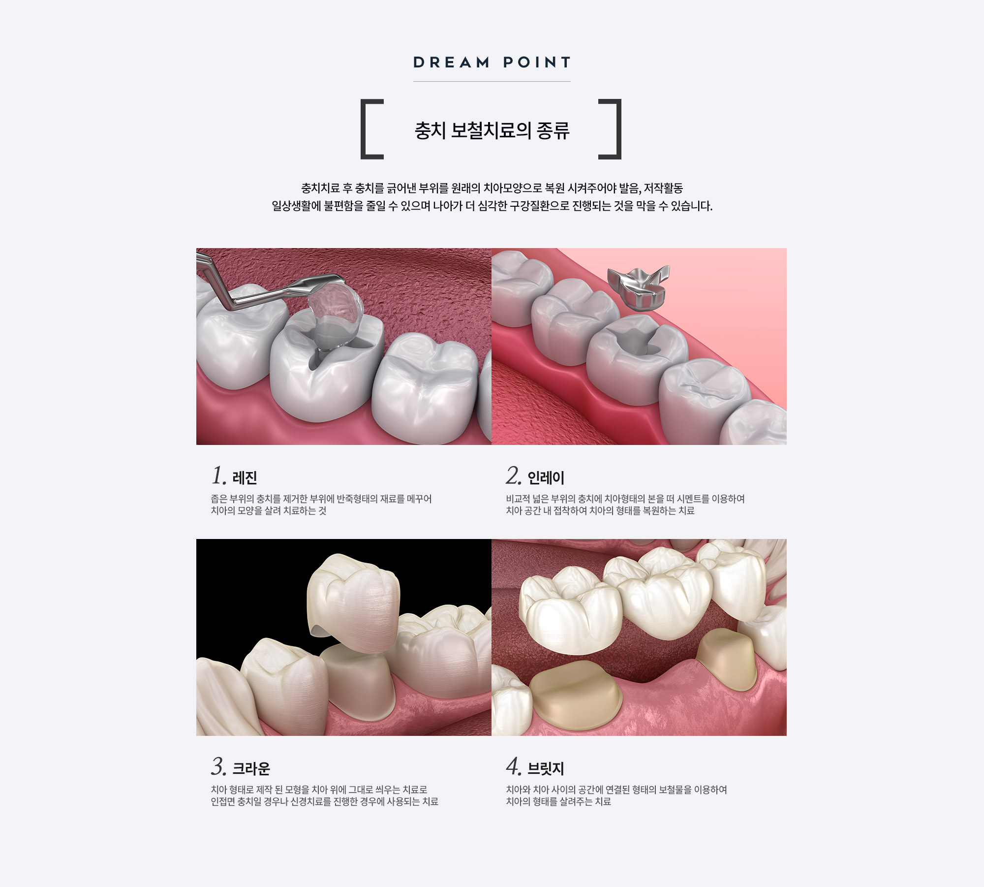 Lingual Bracket Orthodontics
