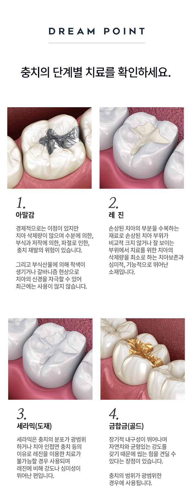 Underbite Correction