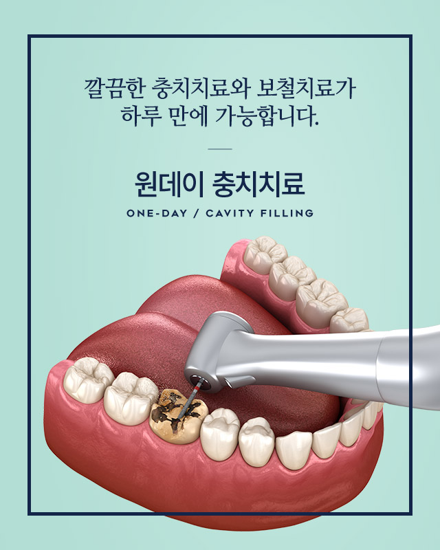 Retainer
