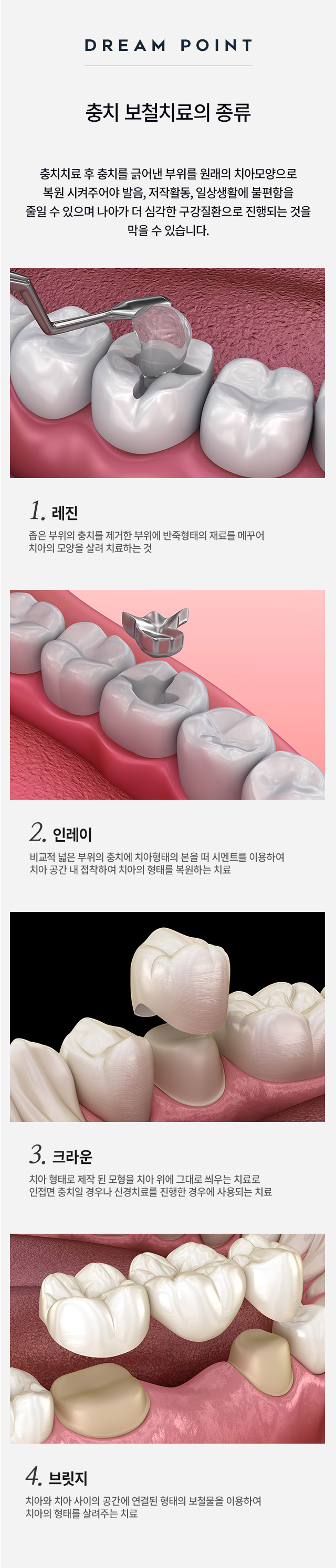 Non-Surgical Orthodontics